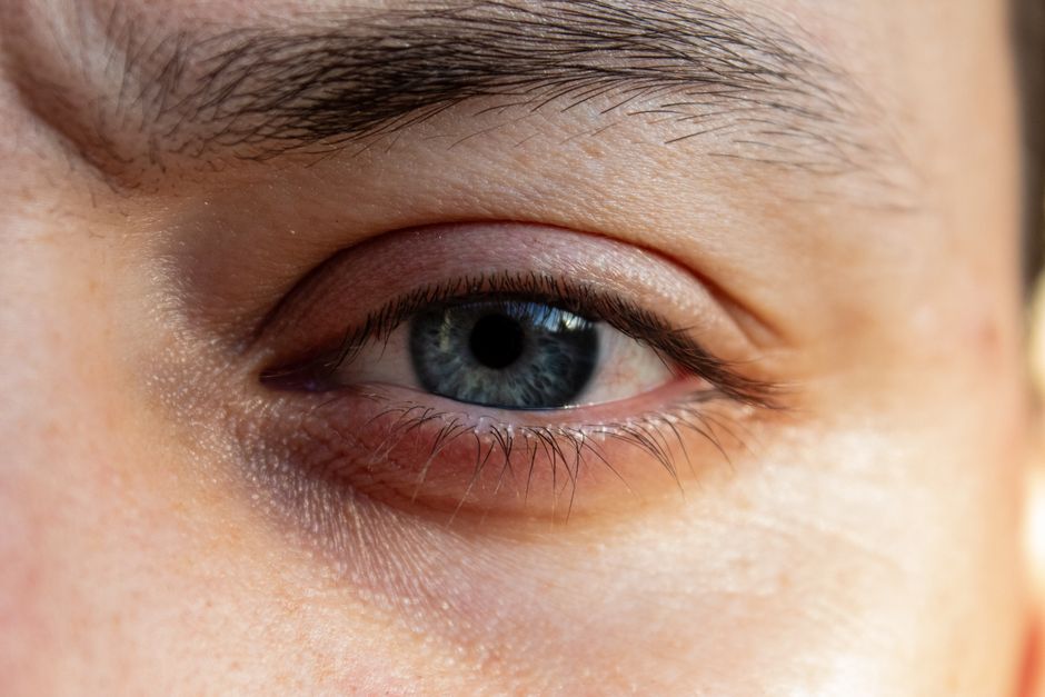 Meibomian gland eyelid examination